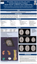White Matter Deficits Correlate with Limbic Structural Asymmetry in Pediatric Bipolar Disorder: A Diffusion Tensor Imaging Study
